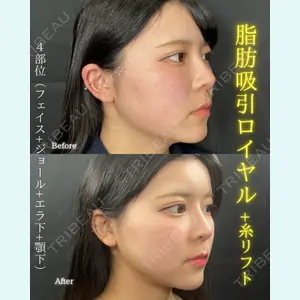 THE FIRST CLINIC 町田院 木暮 啓一郎医師の症例
