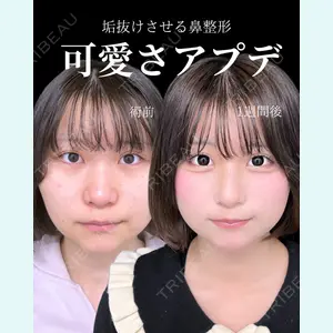 症例