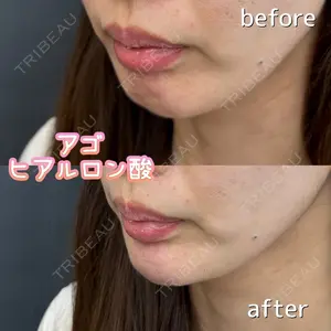 ルラ美容クリニック 沖縄院の症例