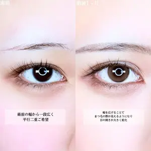 症例