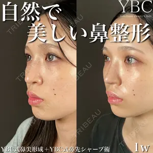 YBC横浜美容外科 大宮院 磯村 亮輔医師の症例