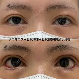 エターナル美容クリニック 久門田 詳医師の症例