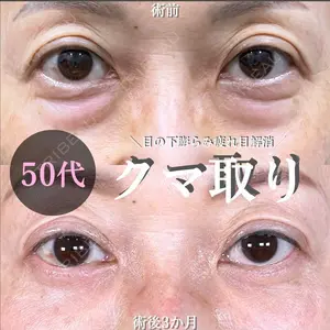 症例