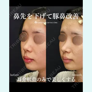 シンデレラ＆ダヴィンチクリニック 宮田 洋佑医師の症例