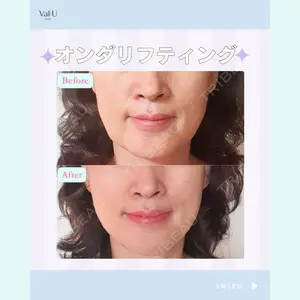 Valu （バリュー） クリニックの症例