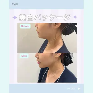 Valu （バリュー） クリニックの症例