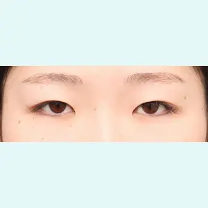 症例