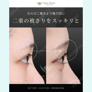 Otus Clinic 【オータスクリニック】 中 徳太郎医師の症例