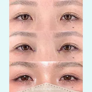 症例