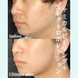 THE FIRST CLINIC 町田院 木暮 啓一郎医師の症例