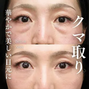 症例