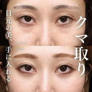 症例