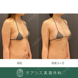 オアシス美容外科 遠藤 剛史医師の症例