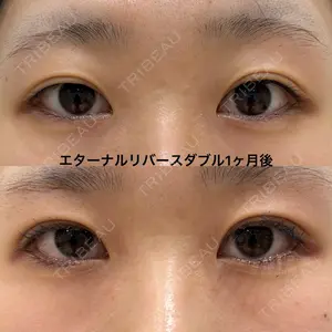 エターナル美容クリニック 久門田 詳医師の症例