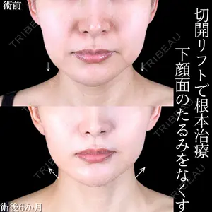 症例