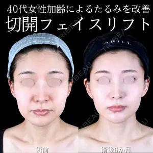 症例