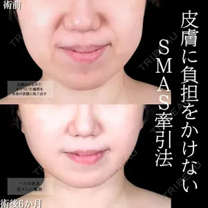症例