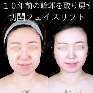 症例