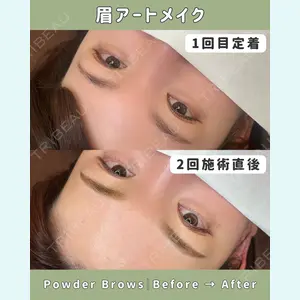 Belle Via Clinic 森田 佑望医師の症例