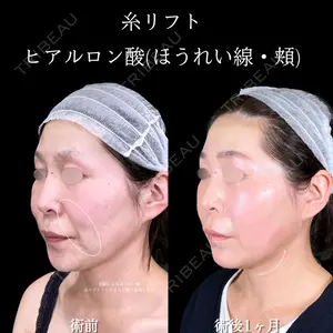 症例