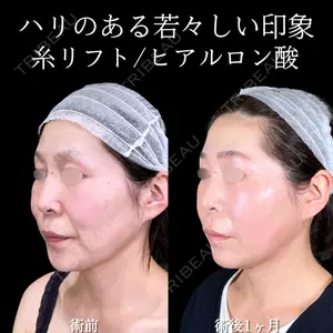 症例