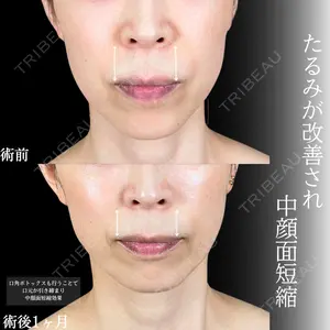 症例