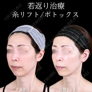 症例