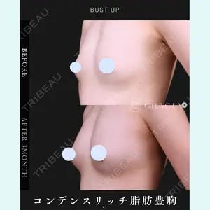 症例
