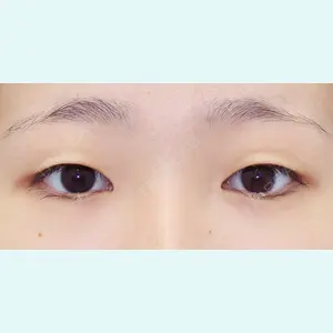 湘南美容クリニック 川崎院 大嶋美喜子医師の症例