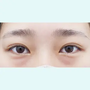 湘南美容クリニック 川崎院 大嶋美喜子医師の症例