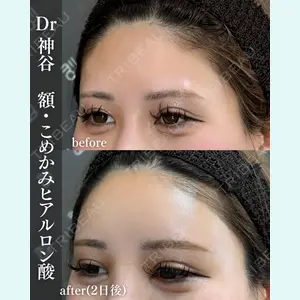 EMMO FACE CLINIC 大阪梅田院 神谷 一成医師の症例