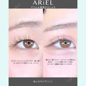 アリエル美容クリニック 郡山院 安齋 誠基医師の症例
