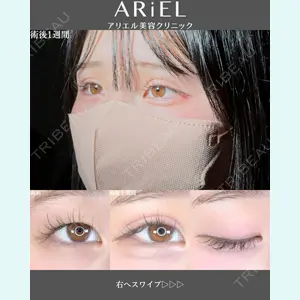 アリエル美容クリニック 郡山院 安齋 誠基医師の症例