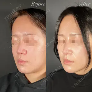 R Beauty CLINIC 大阪院 小池 泰弘医師の症例