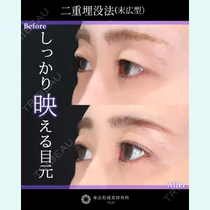 東京形成美容外科 銀座院 中尾 真紀医師の症例