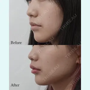 L‘amour clinic Tokyo【ラムールクリニック東京】の症例