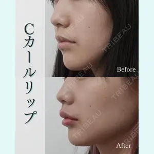 L‘amour clinic Tokyo【ラムールクリニック東京】の症例