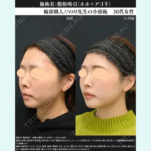 湘南美容クリニック 川崎院 伊藤 賀敏医師の症例