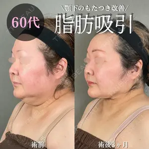 症例