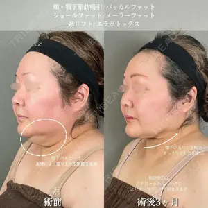症例