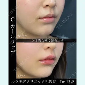 ルラ美容クリニック 札幌院 能登 貴弘医師の症例