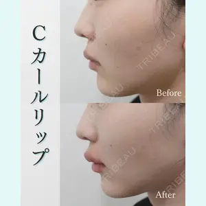 L‘amour clinic Tokyo【ラムールクリニック東京】の症例