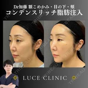 ルーチェクリニック 銀座院 加藤晴之輔医師の症例