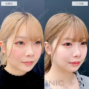 A CLINIC（エークリニック） 福岡院 高平 青洋医師の症例