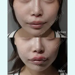 L‘amour clinic Tokyo【ラムールクリニック東京】の症例