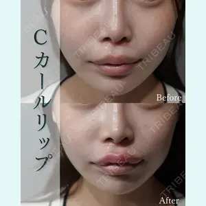 L‘amour clinic Tokyo【ラムールクリニック東京】の症例