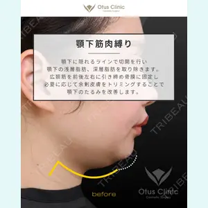 Otus Clinic 【オータスクリニック】 中 徳太郎医師の症例