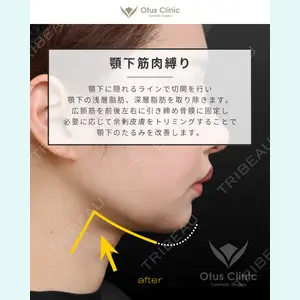 Otus Clinic 【オータスクリニック】 中 徳太郎医師の症例