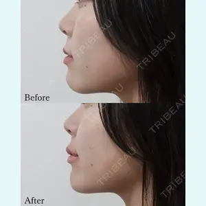 L‘amour clinic Tokyo【ラムールクリニック東京】の症例