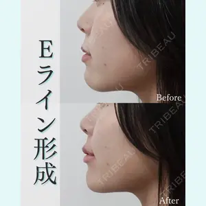 L‘amour clinic Tokyo【ラムールクリニック東京】の症例